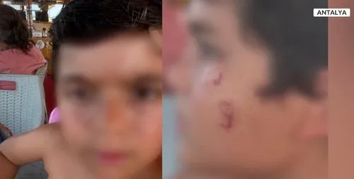 DENİZE GİREN KORKUNÇ HALDE ÇIKIYOR.. VÜCUTTTA KIZARIKLIK KAŞINTI VE YARA